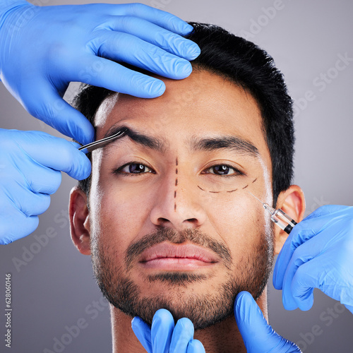 Plastic surgery, brow lift and drawing with portrait of man and surgeon for needle and syringe placement. Hands, face and dermatology of a male person with medical procedure and collagen in studio photo