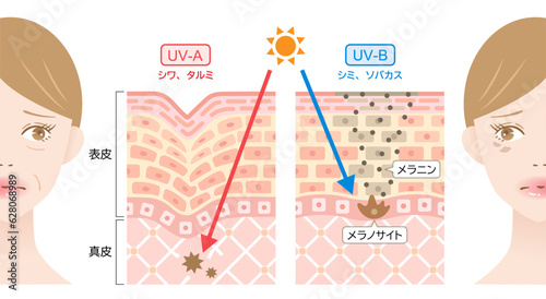 紫外線　UVAとUVB　女性と肌の断面図　