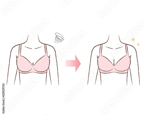 育乳/バストアップ/ブラジャーを着用している体のイラスト ビフォーアフター