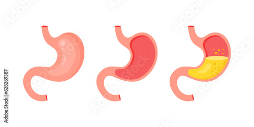 Healthy and unhealthy, empty and full human stomach. Internal organ, anatomy. Internal organ, human gastrointestinal tract. Organ of internal digestion system. Vector illustration in flat style