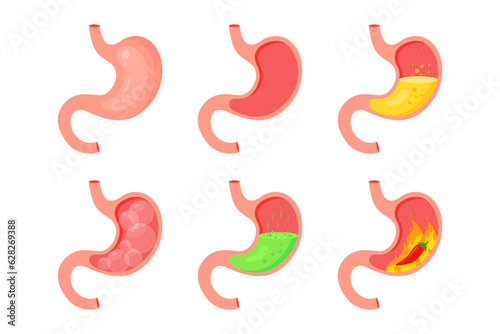 Human stomach. Healthy and unhealthy, empty and full human stomach. Bloating stomach ache, digestive tract pain fullness heaviness stomaches acid heartburn process indigestion photo