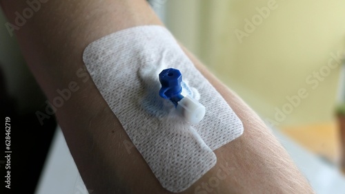 Nurse Inserting Intravenous Catheter Into Patient's Arm