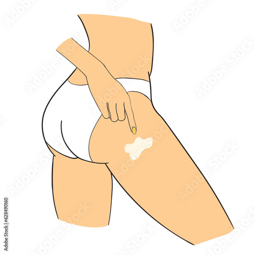 A hand-drawn girl applies an anti-cellulite cream on a white background. The concept of health care.