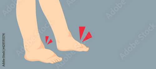 Vector illustration of swelling feet. Healthcare kidney problems drawing