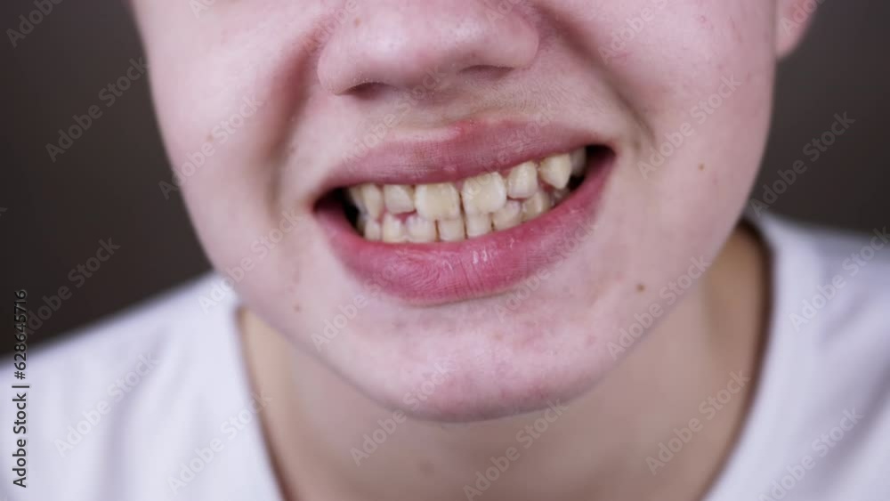 Close up, Child Chews Chewing Gum on a Blurred Background and Shows