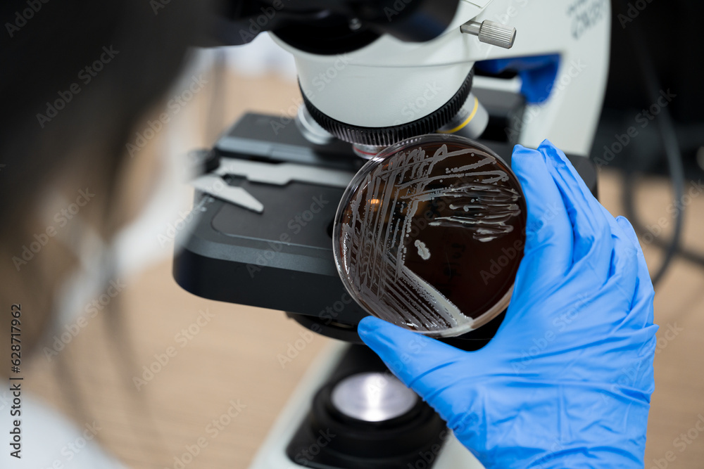Scientist holding agar plate for diagnosis bacterial or