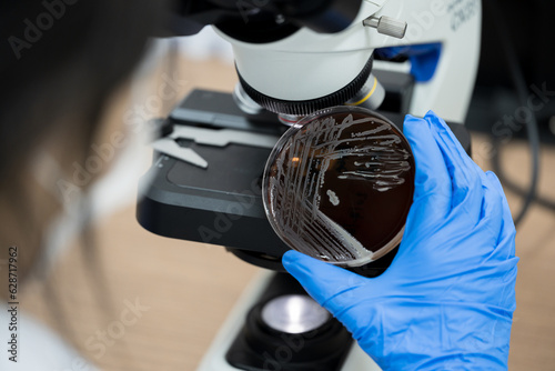 Scientist holding agar plate for diagnosis bacterial or  microorganism, blurry microscopy background at laboratory. Selective petri dish with colonies of bacteria under the lens of a microscope. photo