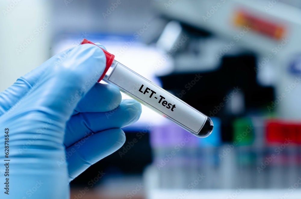 Blood sampling tube for liver function test analysis. Blood sampling tube for liver function test analysis.
