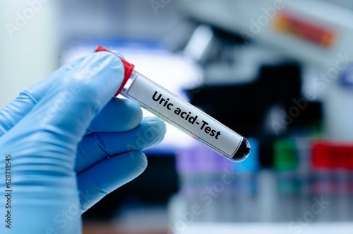 Blood sampling tube for uric acid analysis.