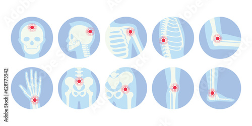 Tableau sur toile Human skeleton pain points icon set vector flat illustration