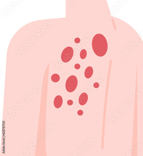 shingles  icon