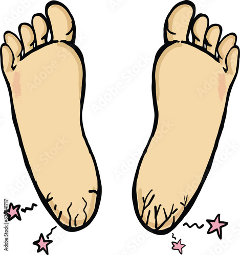 dry cracked heels on white background