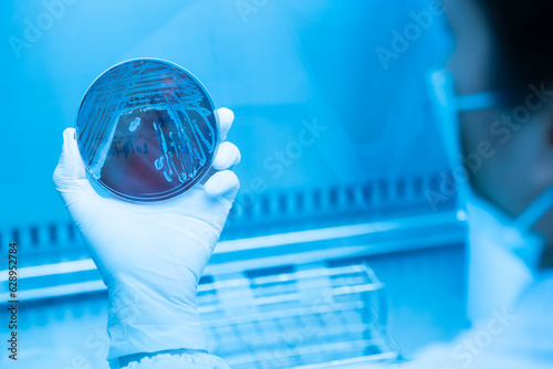 Scientist hand wearing white gloves hold agar plate for diagnosis bacterial or  microorganism at laboratory. Selective petri dish with colonies of bacteria