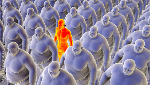 Foto A single normal weight person amidst a large group of overweight people, concept