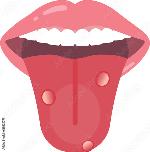 口内炎のある舌 photo