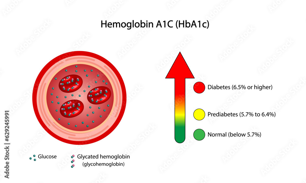 Hemoglobin A1C, HbA1c test results, glycated hemoglobin, A1C Blood