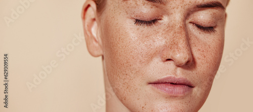 Cropped image of a young female with perfect natural skin with freckles