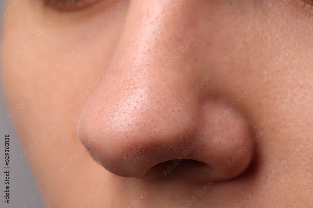 Young woman with acne problem, closeup view of nose Young woman with acne problem, closeup view of nose