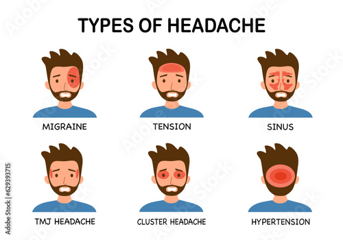 Types of headache set infographic in flat design.