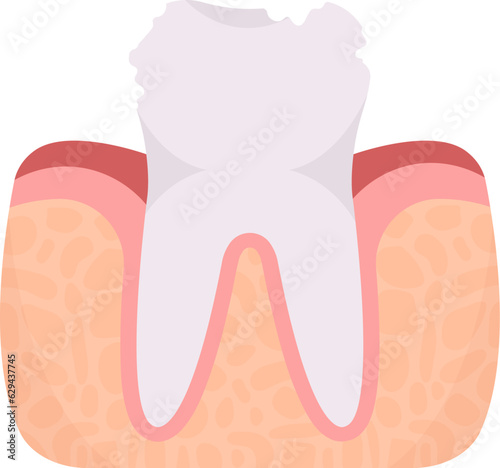 Decayed Tooth Problem