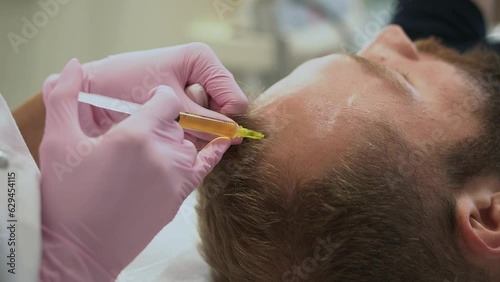 Cosmetologist makes a man prp therapy against hair loss, injections in the scalp in a beauty salon. PRP for hair. The concept of cosmetology.