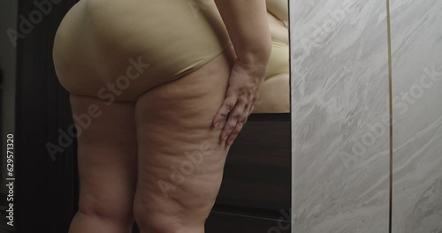 Asian oversize woman care about cellulite on her legs. Excess fat, Unhealthy lifestyle, Diet concept.