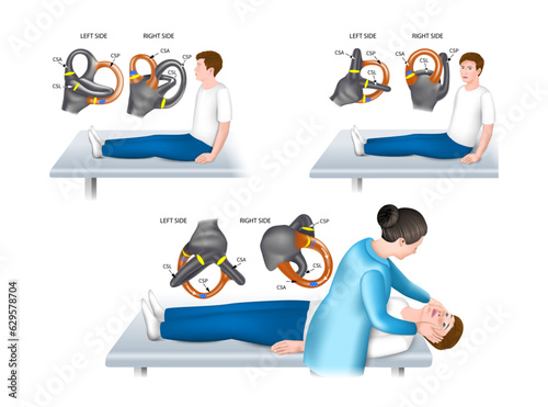 General Dix-Hallpike test