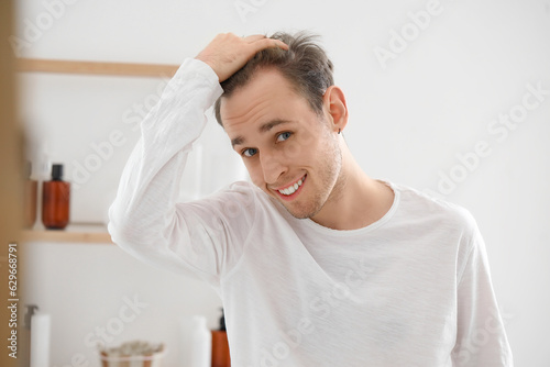 Young man with hair loss pr...