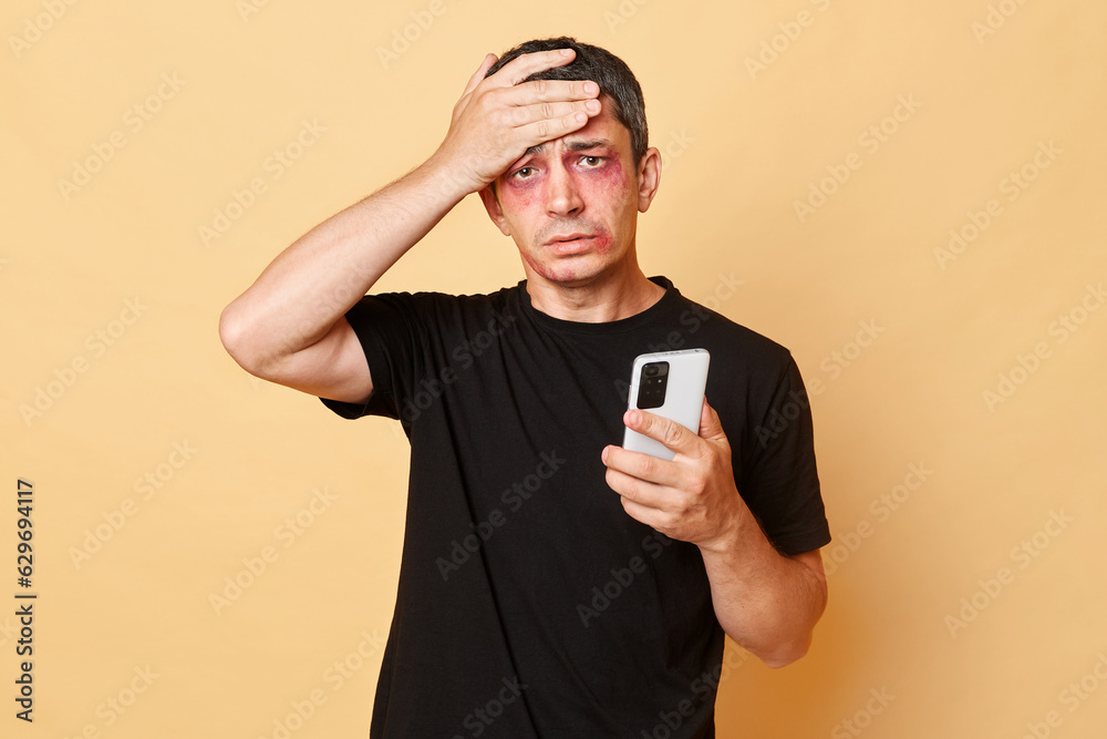 Despair sufferer man in black T-shirt with bruises and abrasions on his face isolated over beige background holding mobile phone searching helpline number needs psychologist help. Despair sufferer man in black T-shirt with bruises and abrasions on his face isolated over beige background holding mobile phone searching helpline number needs psychologist help.