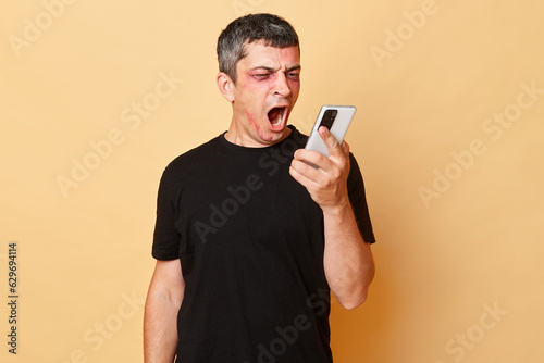 Angry aggressive injured man in black T-shirt with bruises and abrasions on his face isolated over beige background holding smartphone calling to police screaming. © sementsova321