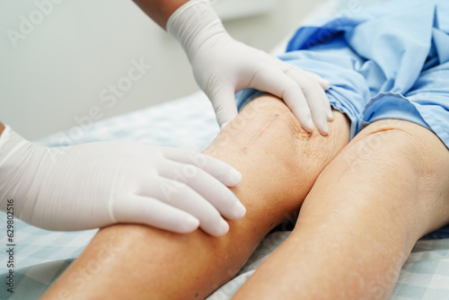 Doctor checking Asian elderly woman patient with scar knee replacement surgery in hospital.