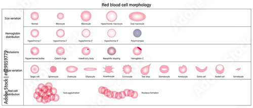 Red blood cell morphology. Size variation, Hemoglobin
distribution, Inclusions, Shape variation and Red cell
distribution vector.