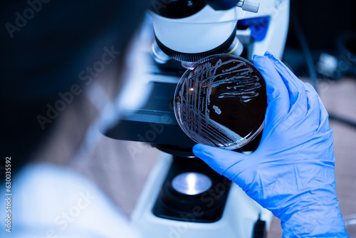 Scientist holding agar plate for diagnosis bacterial or  microorganism, blurry microscopy background at laboratory. Selective petri dish with colonies of bacteria under the lens of a microscope. photo