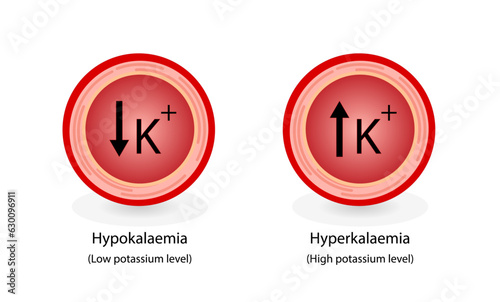 Hyperkalaemia, high plasma potassium level and Hypokalaemia, low plasma potassium level. Potassium K excess and deficit electrolyte disorders, blood test tube, Scientific design. Vector illustration. photo