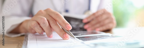 Close up of doctor is engaged in paper work, fills in medical records of patients.