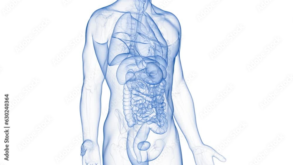 Animation of a neoplasm in the small intestine Animation of a neoplasm in the small intestine