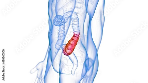 Animation of a blocked colon due to constipation photo