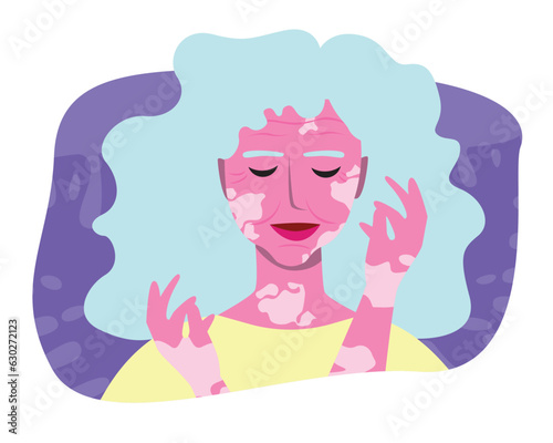 Natural old woman face with vitiligo isolated, mental health concept, vector stock illustration