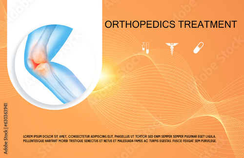Technology for treatment of knee and joint bone injury. Abstract traumatology and orthopedics. Medical science in the hospital for body joints.