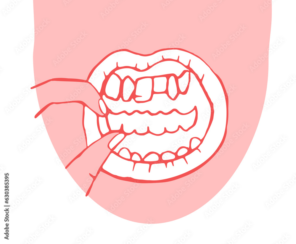 Orthodontic silicone trainer. Invisible braces aligner, retainer.