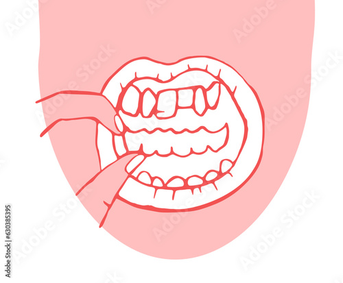 Orthodontic silicone trainer. Invisible braces aligner, retainer.