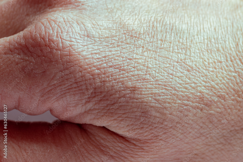 Close up of the wrinkled skin on the hand of an older man with some lesions of actinic keratosis or sunspots