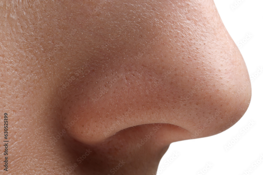Young woman with acne problem on white background, closeup view of nose Young woman with acne problem on white background, closeup view of nose