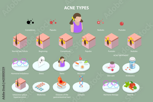 3D Isometric Flat Vector Conceptual Illustration of Acne Types, Skin Care