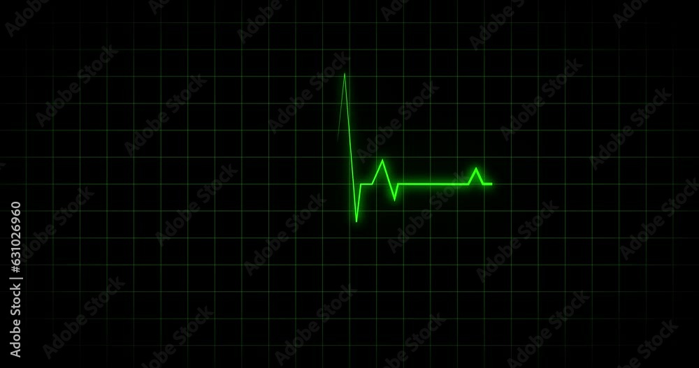 Cardiogram heartbeat thermal impulse glowing green neon light. background EKG. seamless loop Cardiogram heartbeat thermal impulse glowing green neon light. background EKG. seamless loop