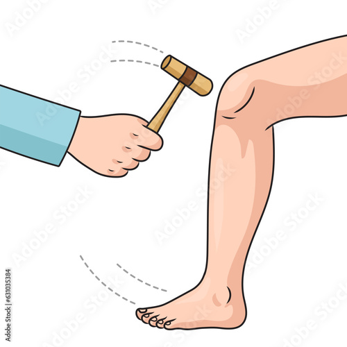 The doctor checks patellar reflex with a hammer diagram schematic vector illustration. Medical science educational illustration