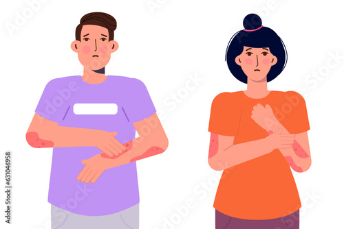 Woman and man with psoriasis. Vector illustration