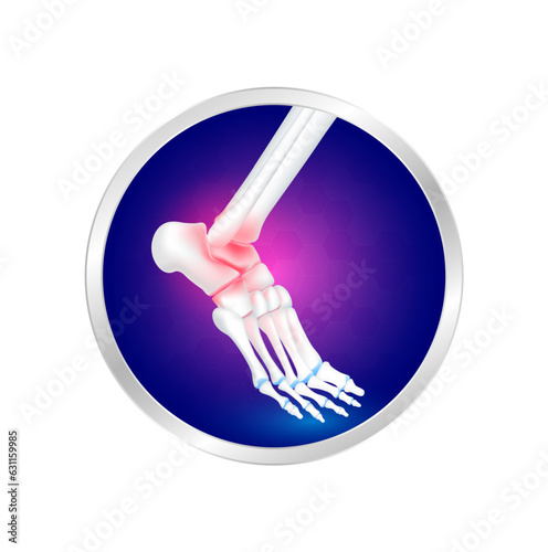 Ankle bone foot traumas and arthritis joint cartilage in label aluminum. Human skeleton anatomy. Foods logo products template design. Medical food supplement concepts. Vector EPS10.