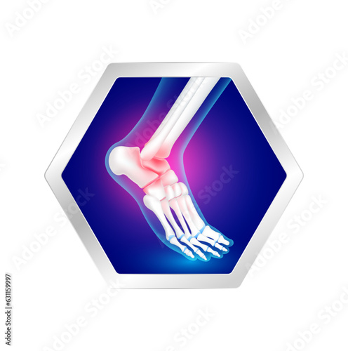 Ankle bone foot traumas and arthritis joint cartilage in hexagon label aluminum. Human skeleton anatomy. Foods logo products template design. Medical food supplement concepts. Vector EPS10.