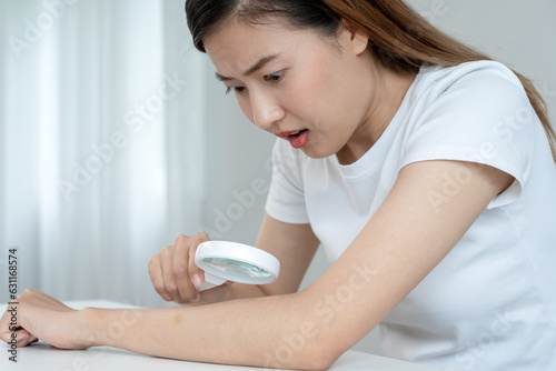 skin problem and beauty. asian woman use magnifying glass look itchy skin from skin allergic, shocked, steroid allergy, sensitive skin, chemical allergy, rash, insect bites, Seborrheic Dermatitis.
